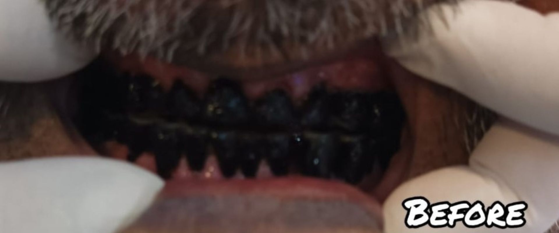 Smile Makeover Before After - Dr. Sadaf Dental Care